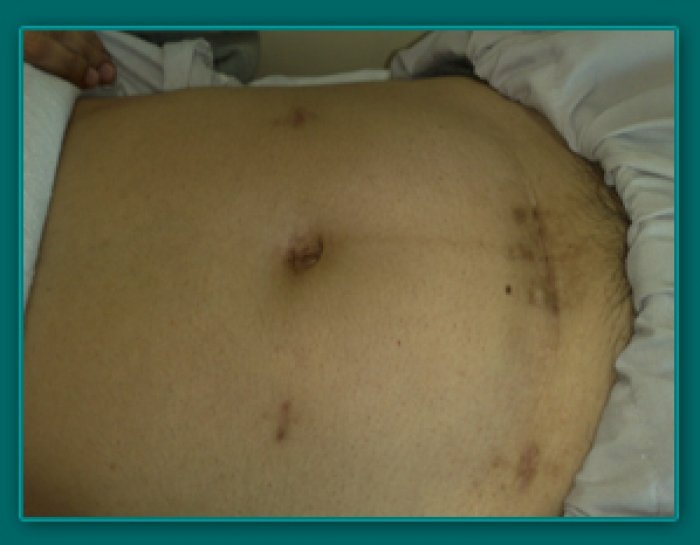 1733835584_d4663b0e8ae42f796740