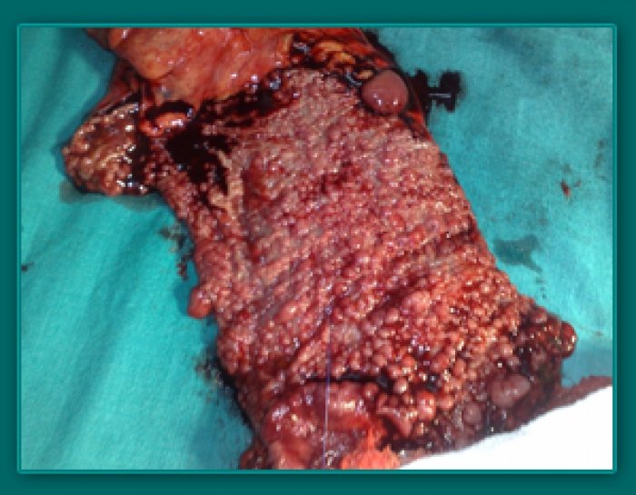 1733835700_44c847a748e68236a924