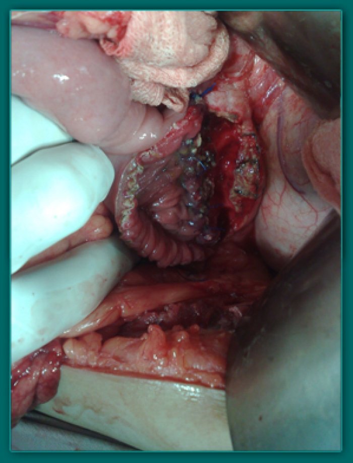 1733835802_6ffbc7486ae4c9a3f4b9