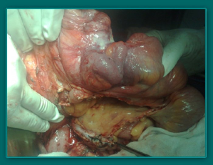 1733835825_65cc0acfcbd7ffe87a24