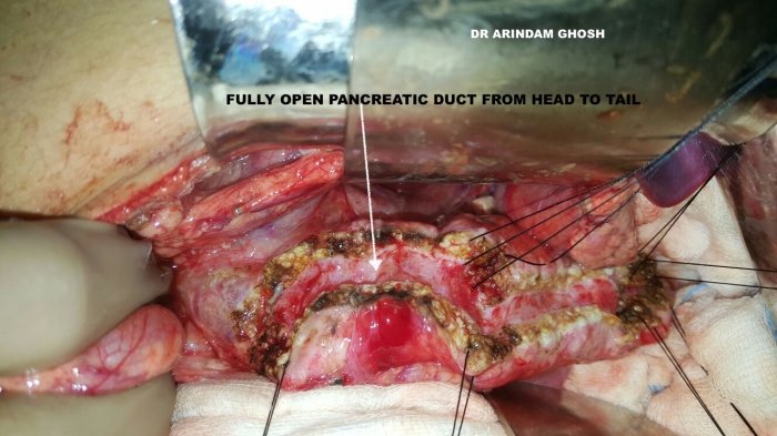 1733835857_5b5fdfa41014016eceb8