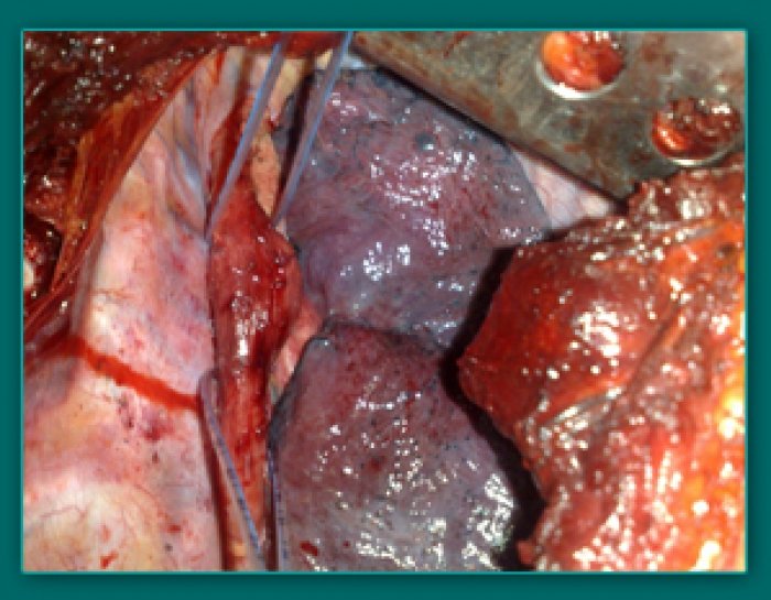 1733835923_0ee9d6c463bd36d18902