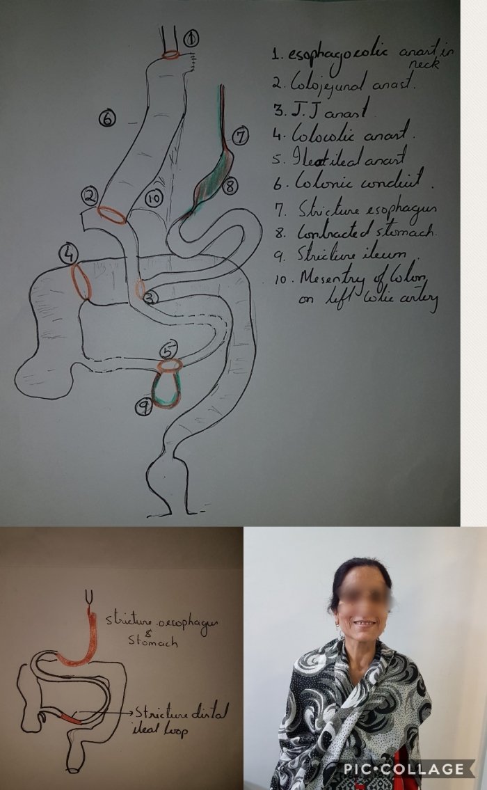 1733835992_fbd14275371dd7d563f6