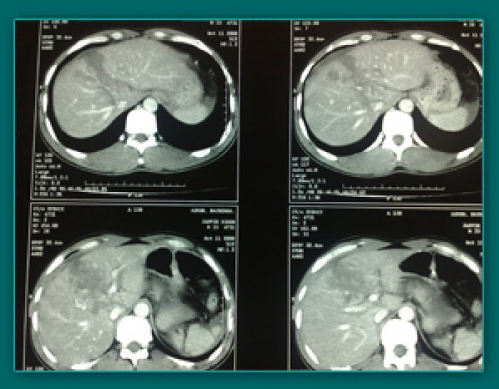 1733836135_fbd7c1af04dcfd01ed05