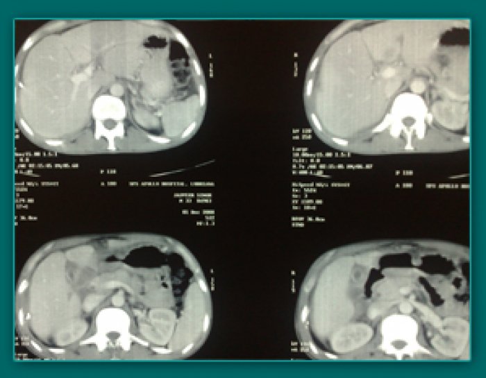 1733836225_e9d7cbc751eeaff1a675