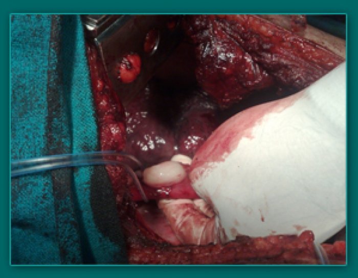 1733836248_07b6716290c7d96fe4c8