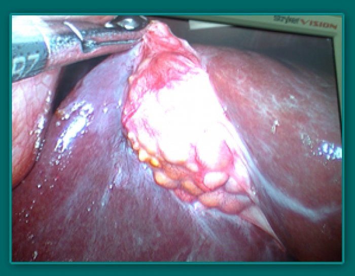 1733836349_2dc173223c28d62ebcd9