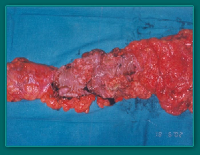 1733836369_b95a7433ac5b86000a60