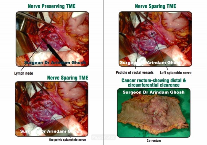 1733836425_8abe3b896d4427879b9f