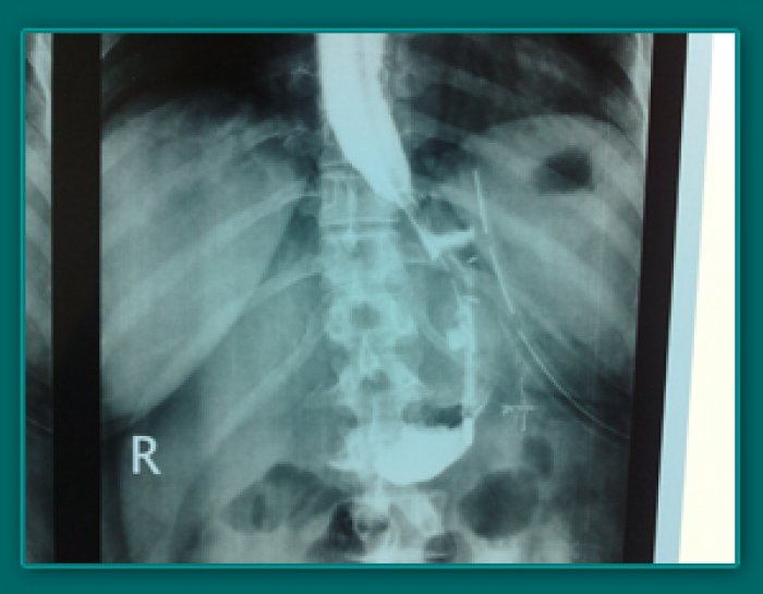 1733836474_798e0c84ab741c16f7d6