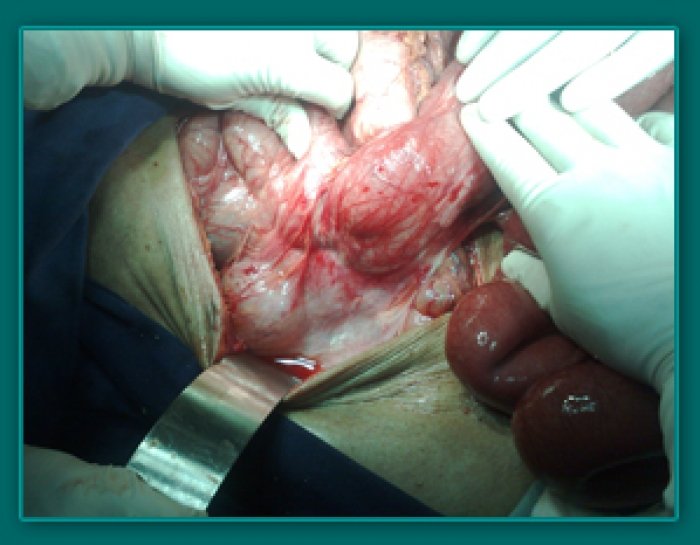 1733836538_cfe78576d425a955e477